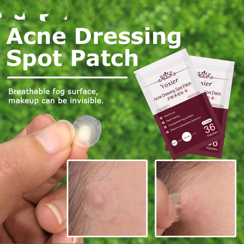 Acne Pimple Patch – Invisible Spot Treatment Stickers for Blemish & Pimple Care