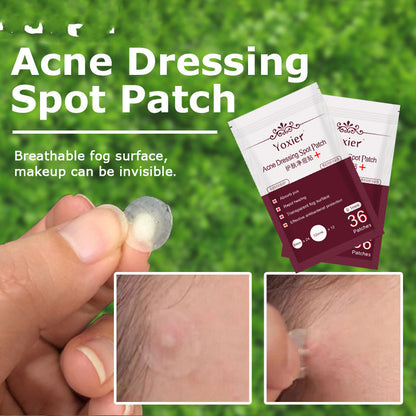 Acne Pimple Patch – Invisible Spot Treatment Stickers for Blemish & Pimple Care